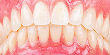 虫歯、歯周病以外の口腔内の痛みに対応